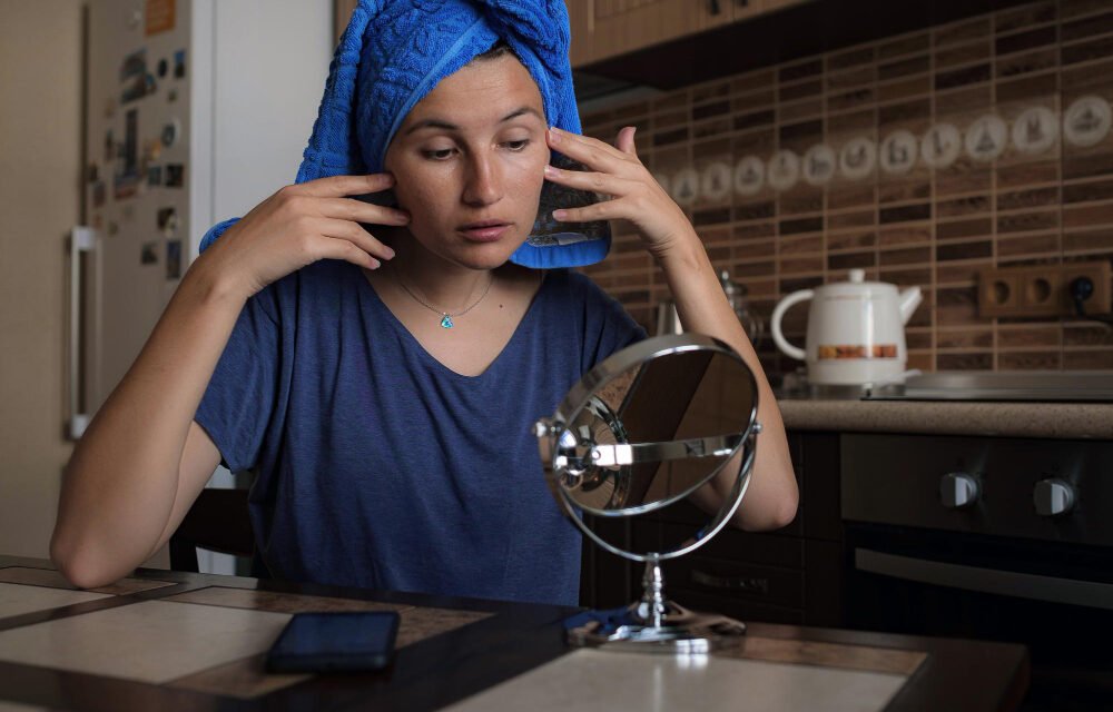 Say Bye to Acne: 5 Monsoon Diet Tips for Glowing Skin